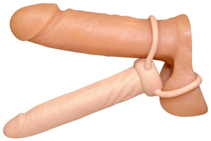 Anal Special nature